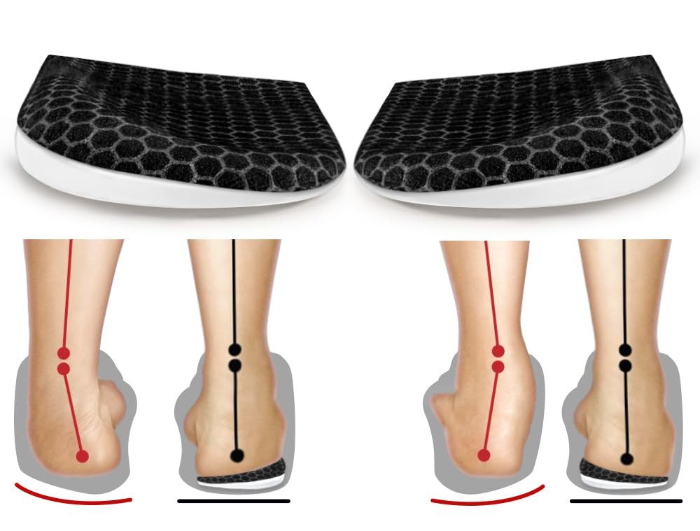 Corrective Insoles for Supination & Over-Pronation, Orthotics Medial & Latera…
