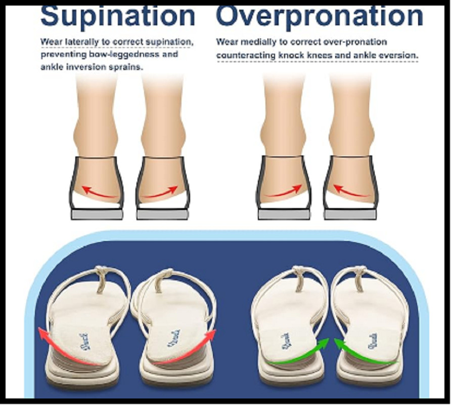 Urwalk 3 Layers Adjustable Supination & Over-Pronation Corrective Shoe Inserts,