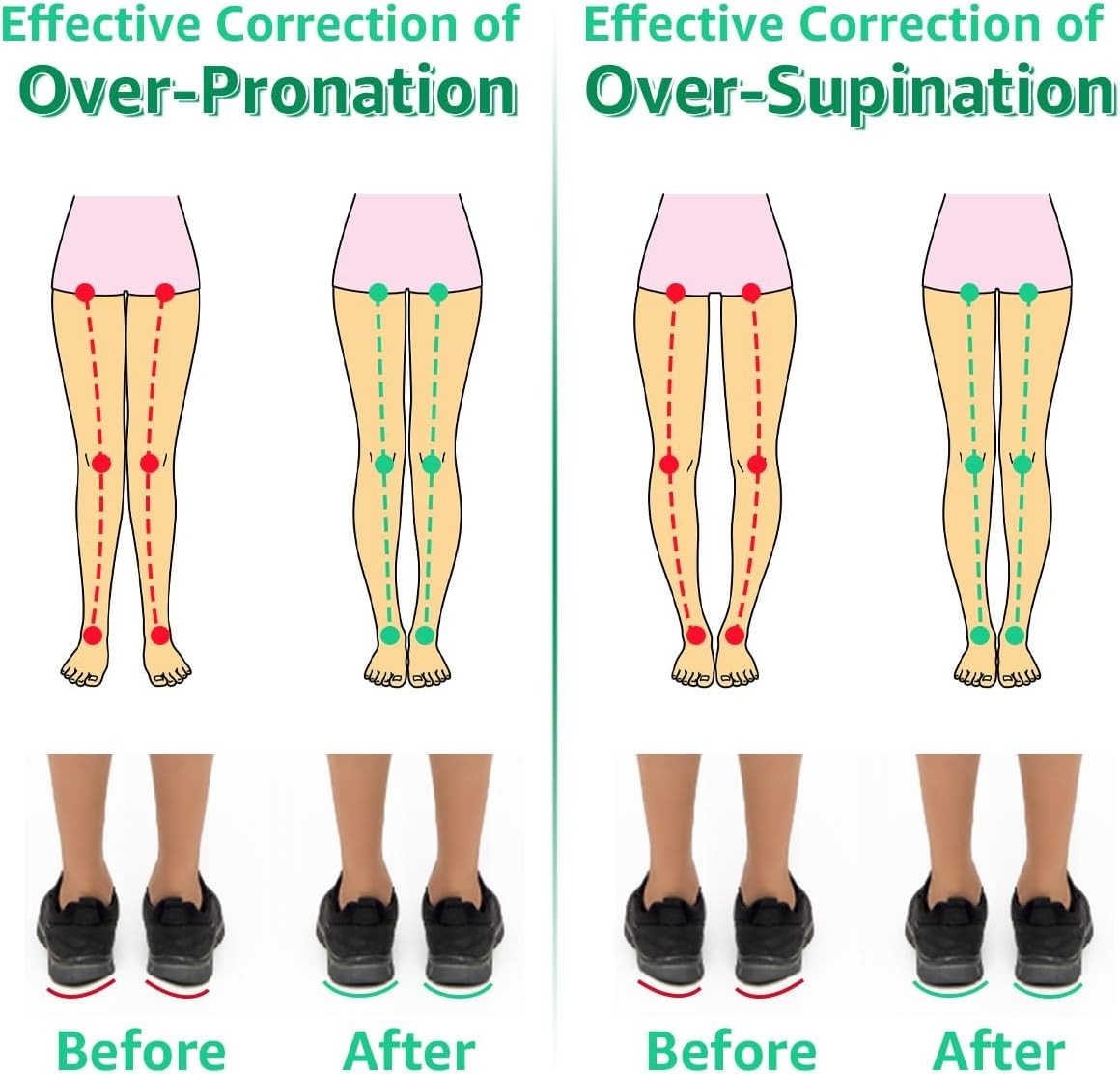 3 Layers Adjustable Heel Wedge Inserts for Supination & Pronation Correction, Ad