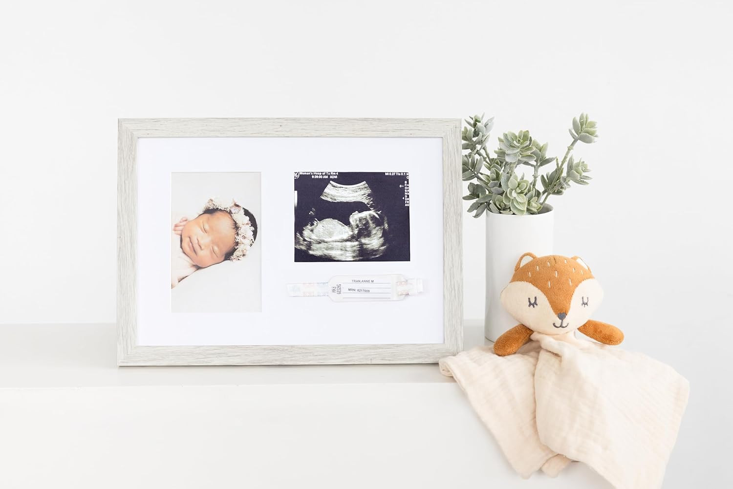 Rustic Baby Keepsake Frame with Sonogram, Photo and Hospital ID Bracelet Display