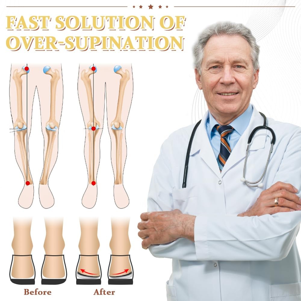 BIGGCOOL Corrective Insoles for Supination & Over-Pronation, Orthotics Medial…
