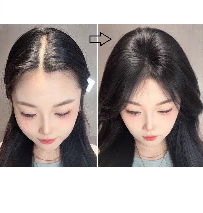 3.13″x4.3″Traceless Front Lace 100%Human Hair Hairline Topper Cover Head Top 10″