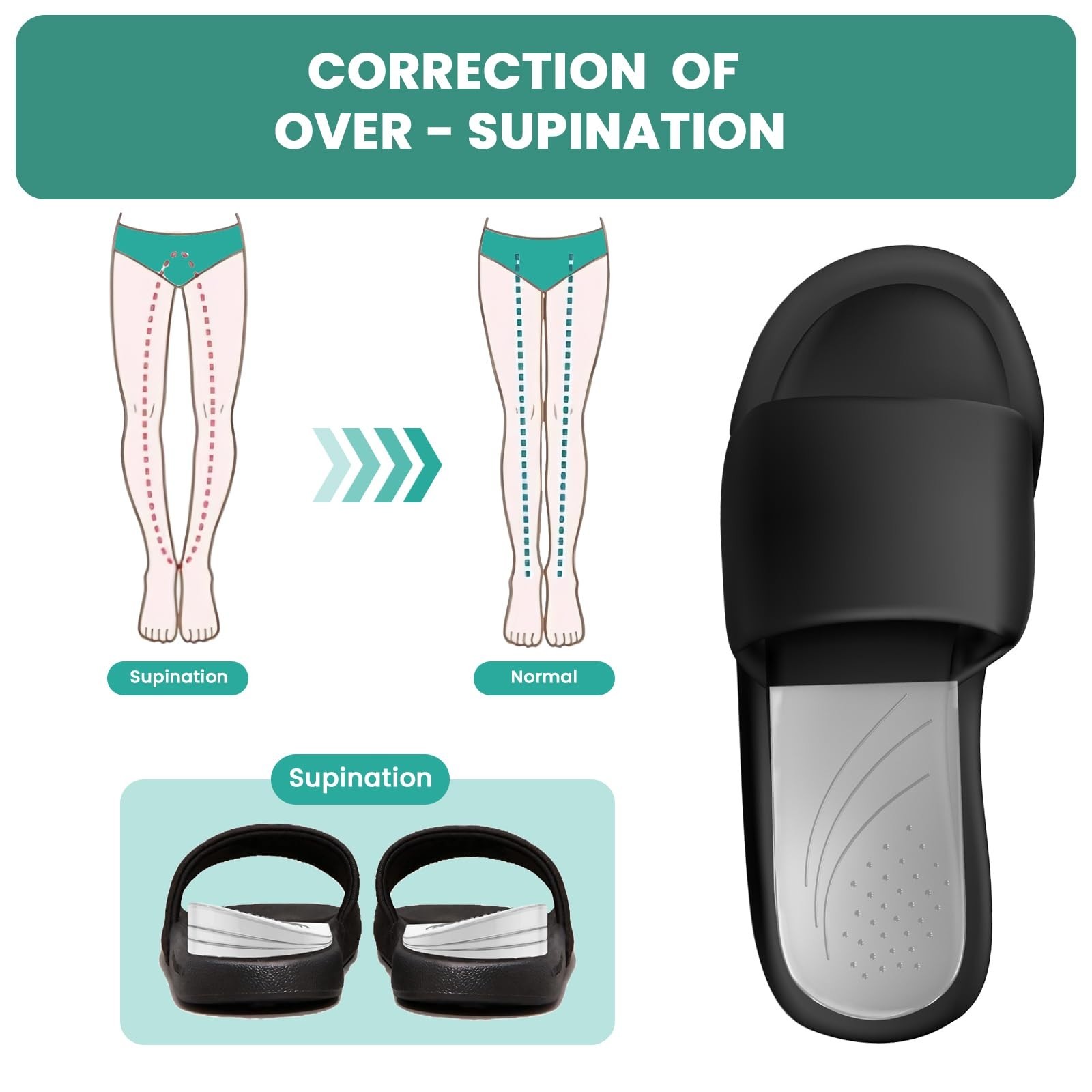 Adjustable Heel Wedge Insoles for Supination & Pronation – 2 Pairs, Knee Pain Re