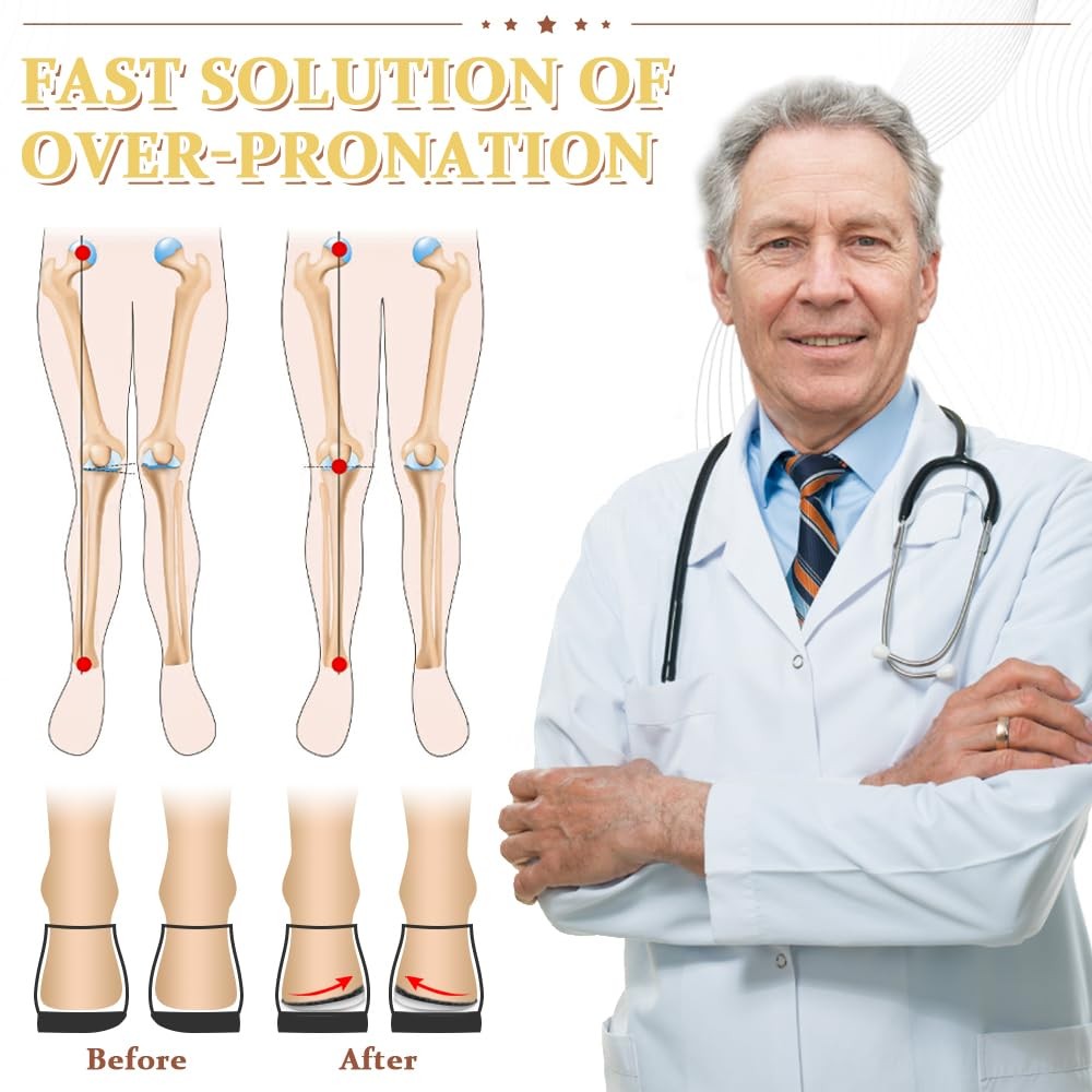 BIGGCOOL Corrective Insoles for Supination & Over-Pronation, Orthotics Medial…