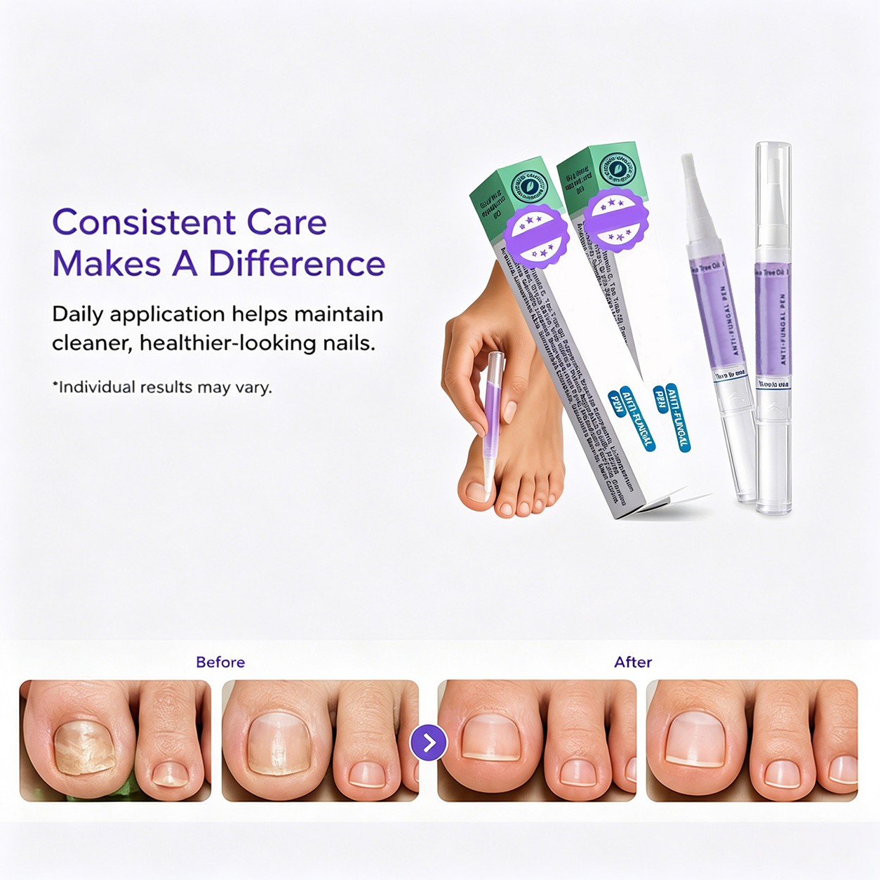 1/2/3 Pcs Orivelle Antifungal Pen, Swissclear Anti Fungal Pen, Anti Fungal Nail