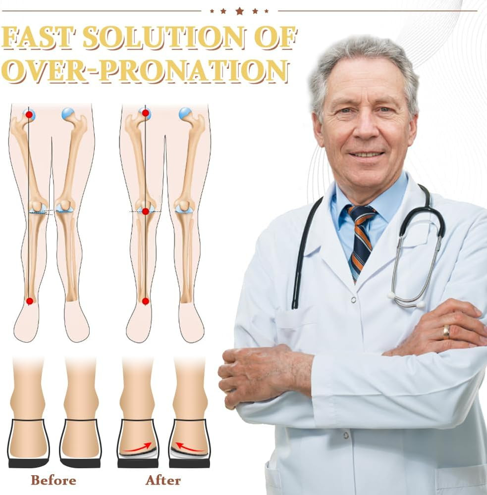 BIGGCOOL Corrective Insoles for Supination & Over-Pronation, Orthotics Medial &