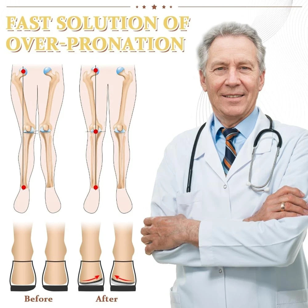 Corrective Insoles for Supination & Over-Pronation, Orthotics Medial & Latera…
