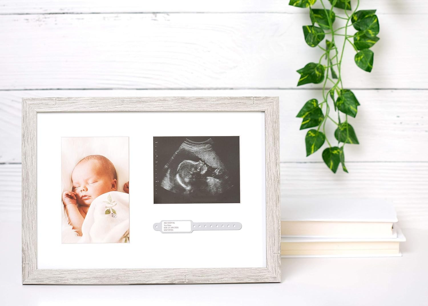 Rustic Baby Keepsake Frame with Sonogram, Photo and Hospital ID Bracelet Display