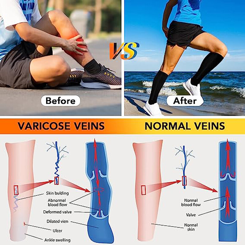 Zipper Pressure Compression Socks Pain Relief Calf Leg Foot Support Stocking US