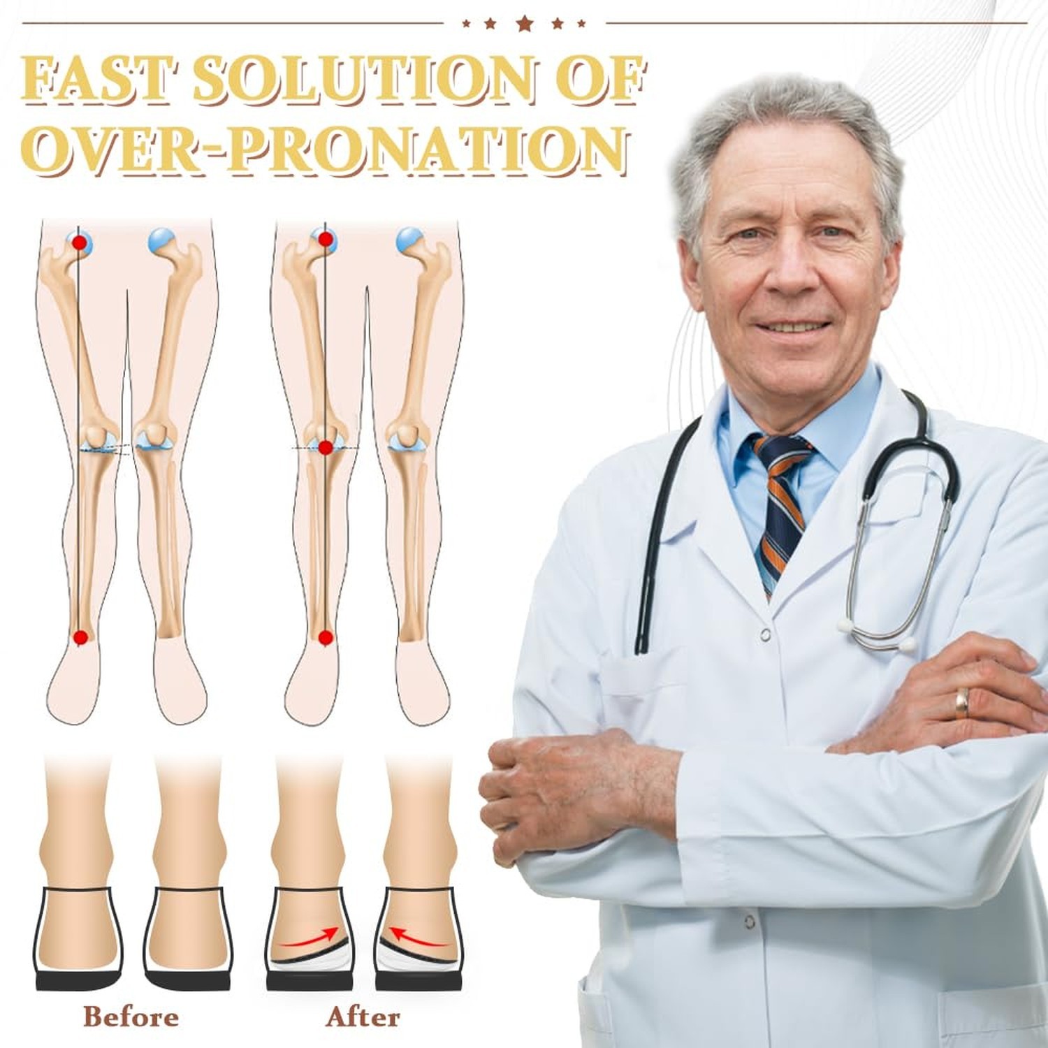 BIGGCOOL Corrective Insoles for Supination & Over-Pronation, Orthotics Medial…