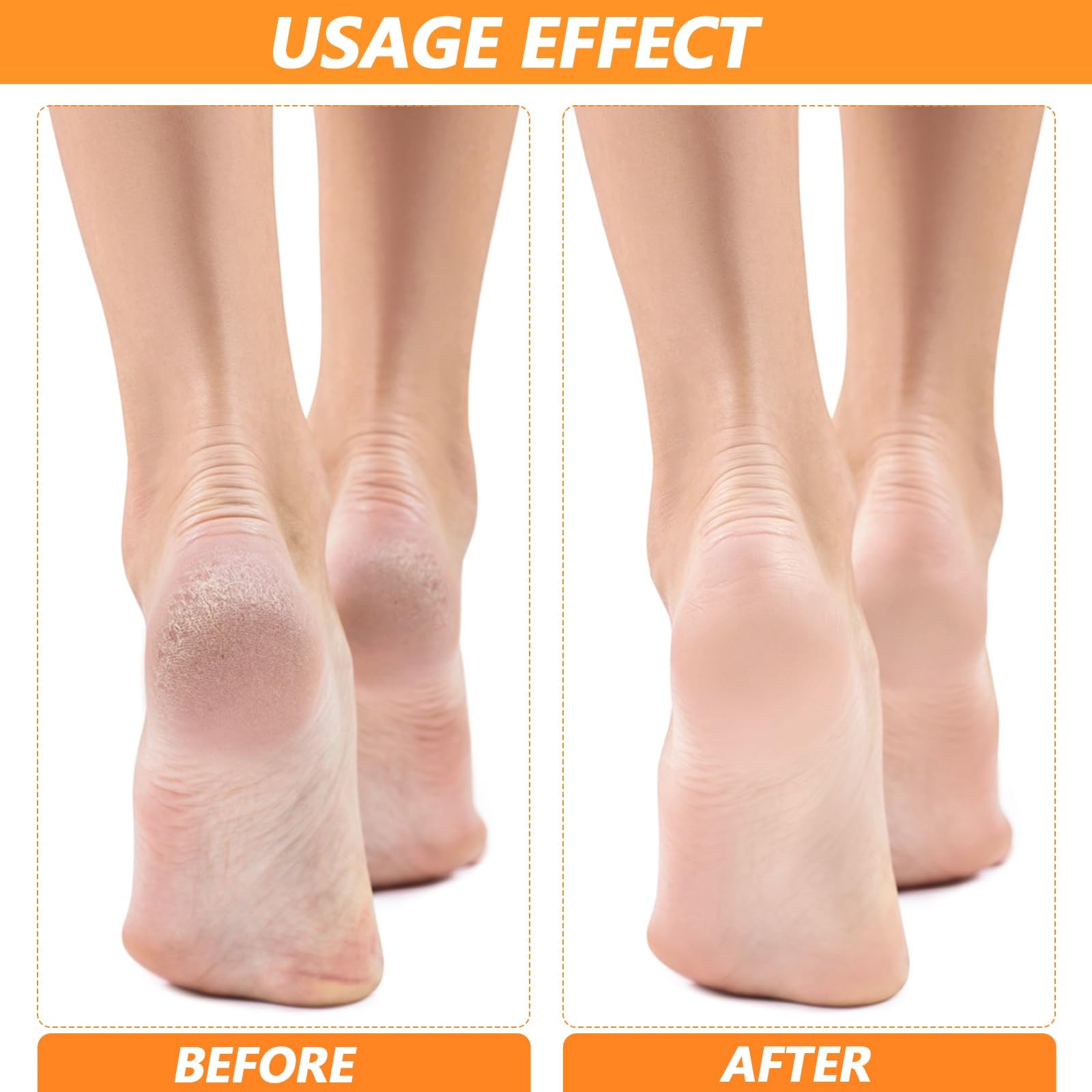 TIESOME 4 Pairs Silicone Gel Heel Protectors, White Soft Breathable