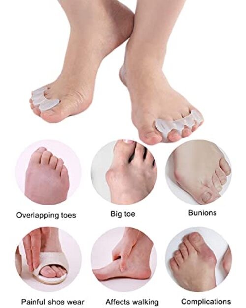 2Pairs Toe Separators Toe Spacers for Women Men to Correct Bunion, Relieve