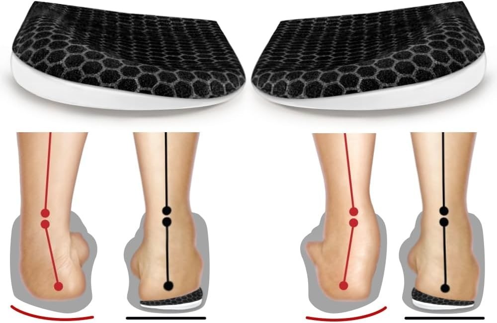 Corrective Insoles for Supination & Over-Pronation, Orthotics Medial & Lateral H