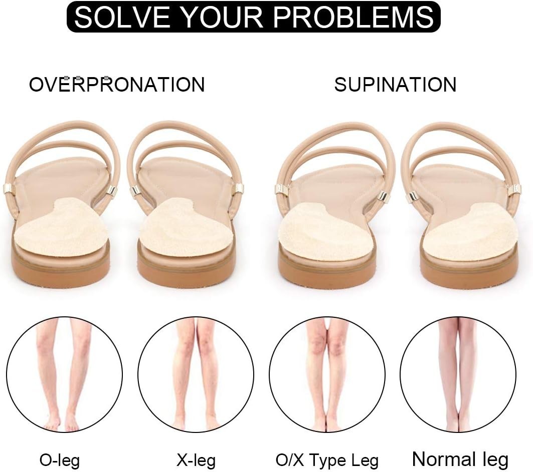 Dr. Foot’s Supination & Overpronation Insoles for Foot Alignment – Medium Size