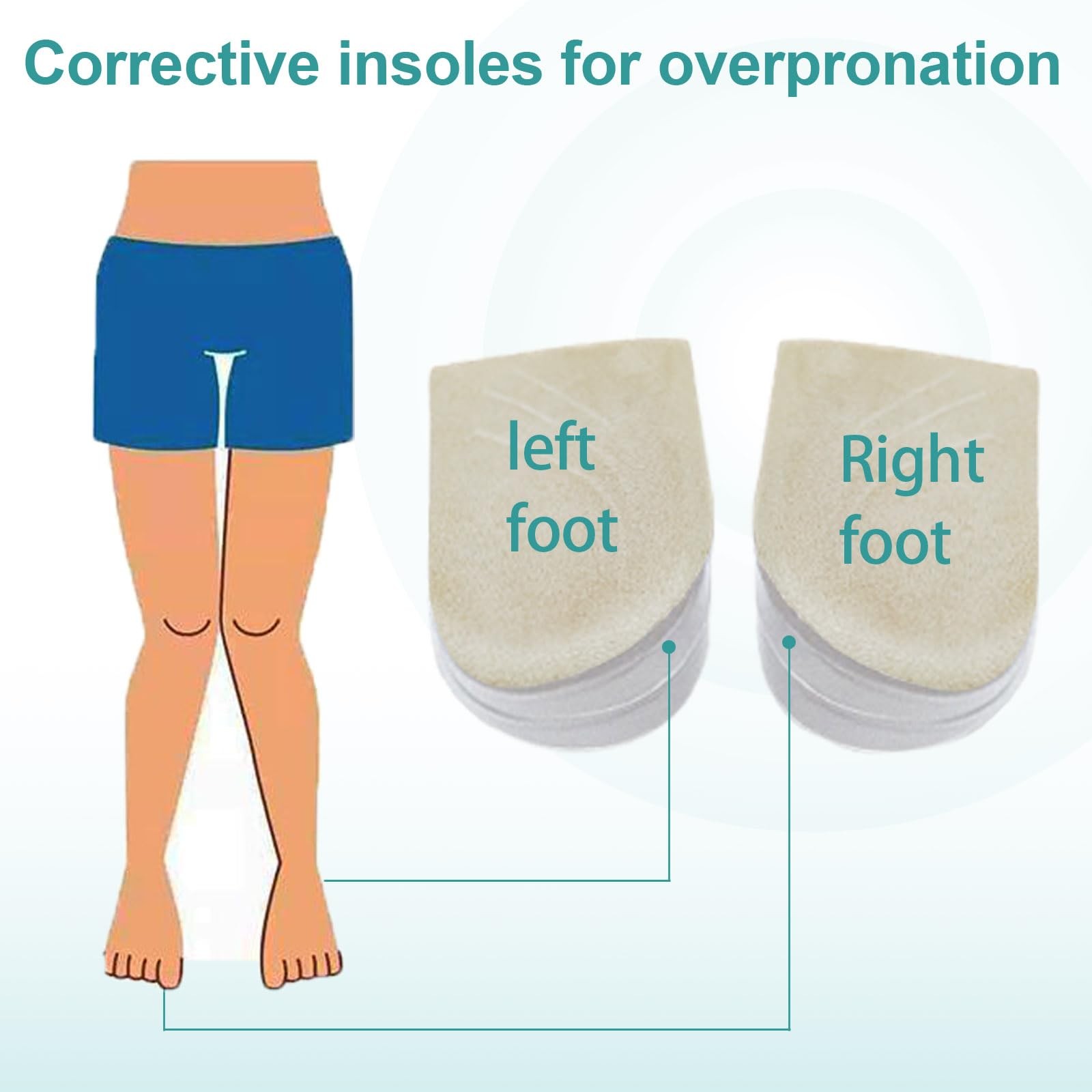 Corrective Insoles for Supination and Pronation, 3 0.5 Cm, 1.1 Apricot