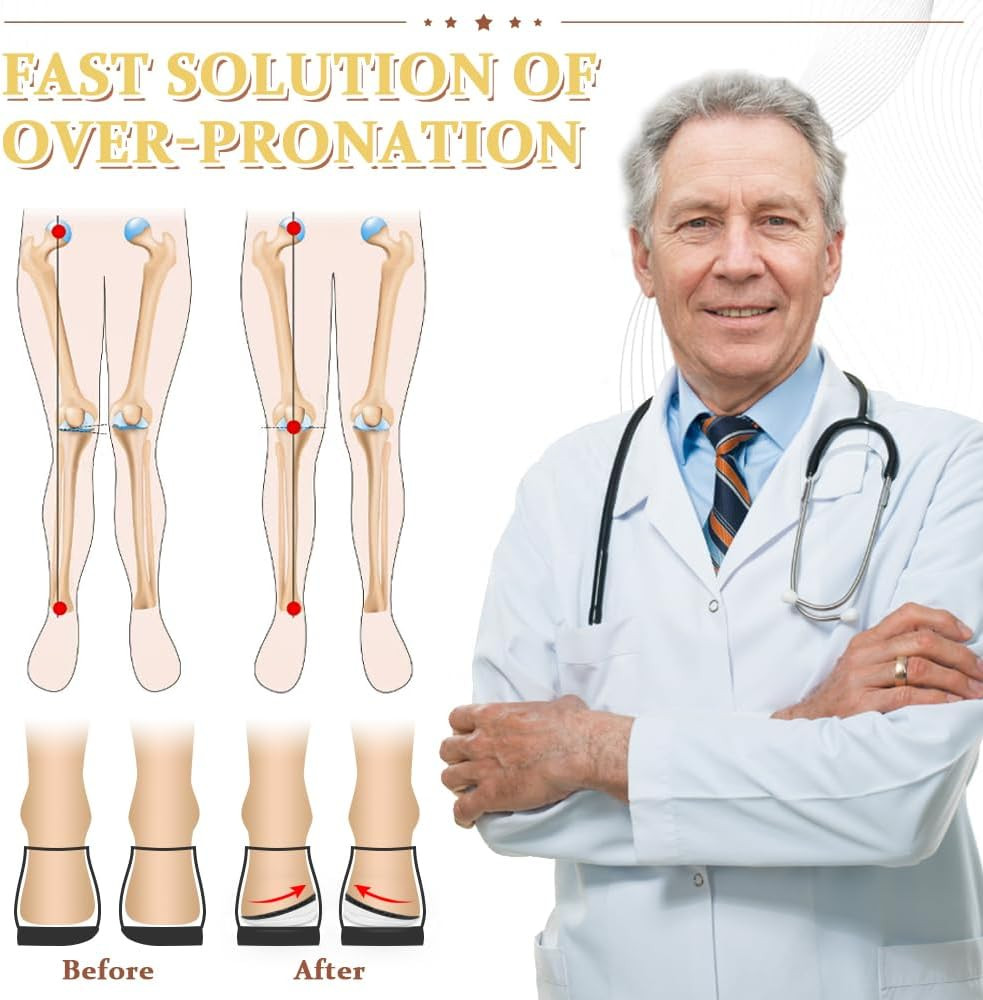 Corrective Insoles for Supination & Over-Pronation, Orthotics Medial & Lateral