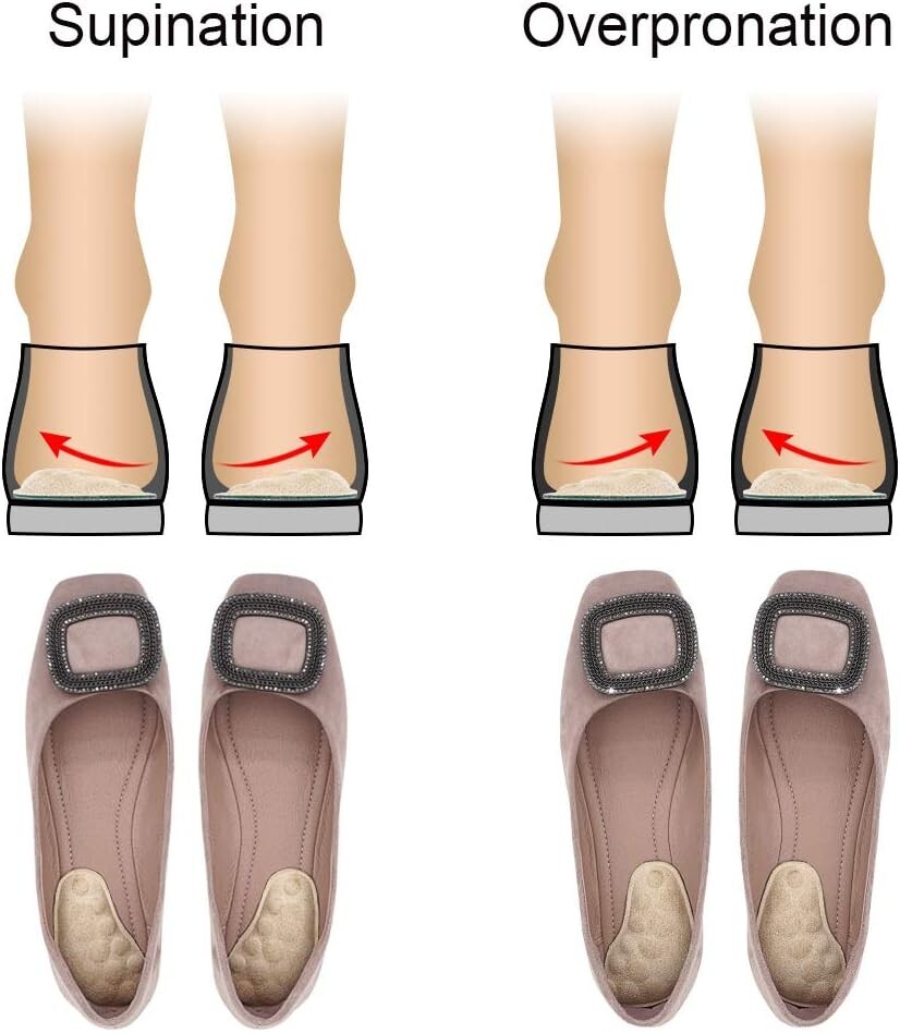 Supination & Over-Pronation Shoe Inserts for Foot Alignment – 3 Pairs (Black)