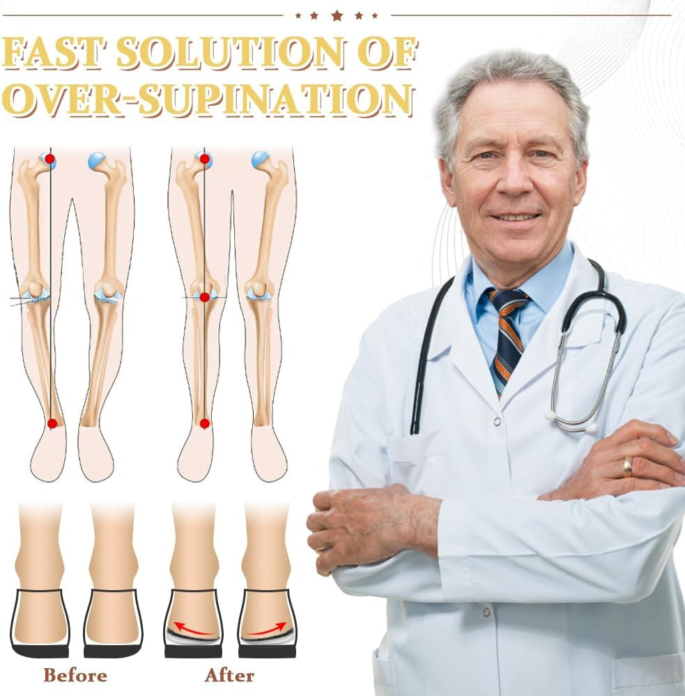 BIGGCOOL Corrective Insoles for Supination & Over-Pronation, Orthotics Medial &