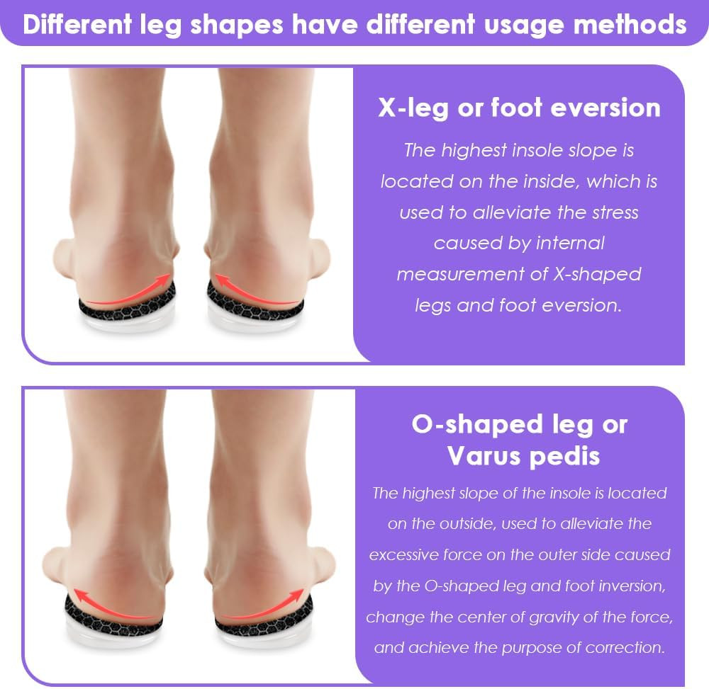 3 Layers Adjustable Supination Overpronation Insoles, Anti-Slip Medial Lateral H