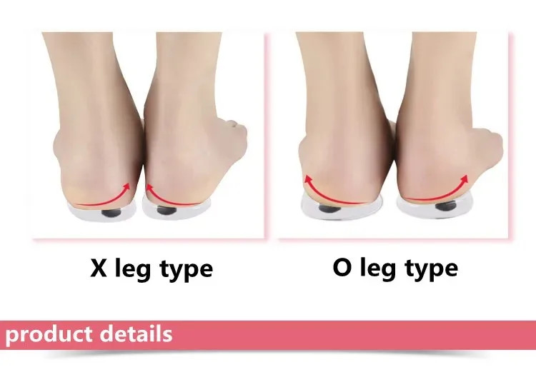 Silicone Orthopedic Insoles with Magnet Massage Foot Care O/X Leg Type Valgu Var