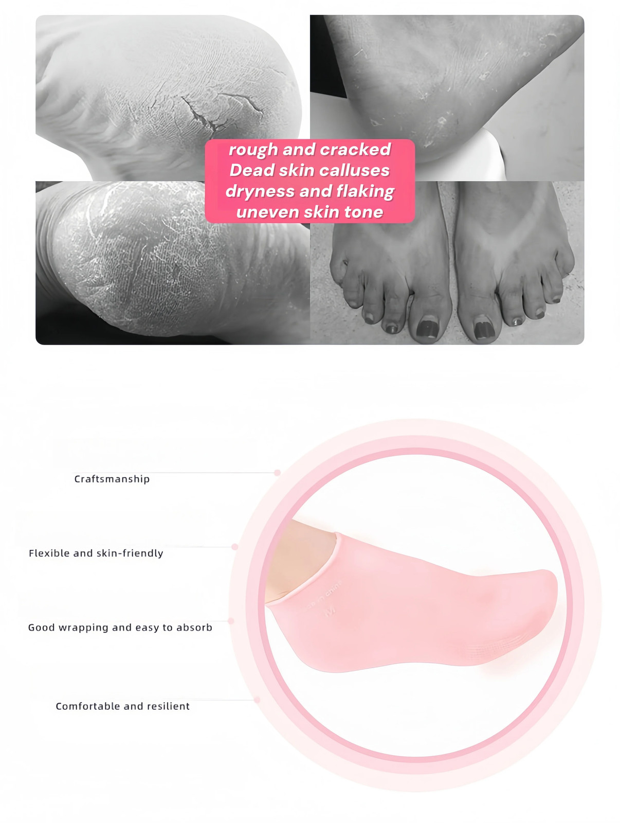 Women Massage Moisturizing Silicone Foot Socks for Dry Cracked Feet Hydrating