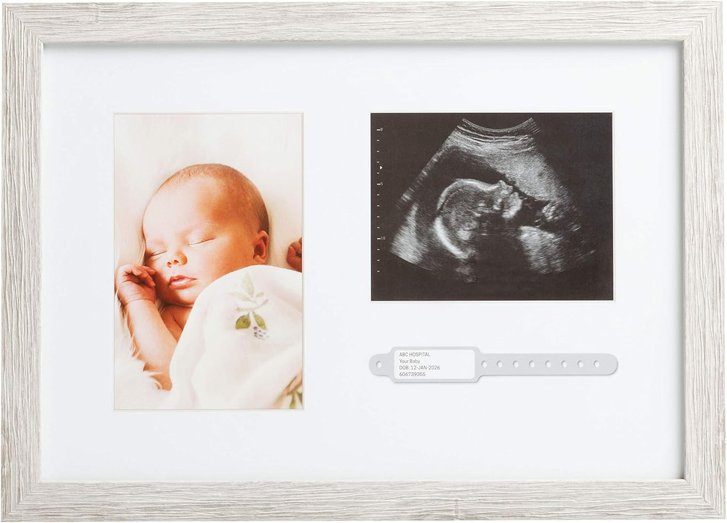 Rustic Baby Keepsake Frame with Sonogram, Photo and Hospital ID Bracelet Display