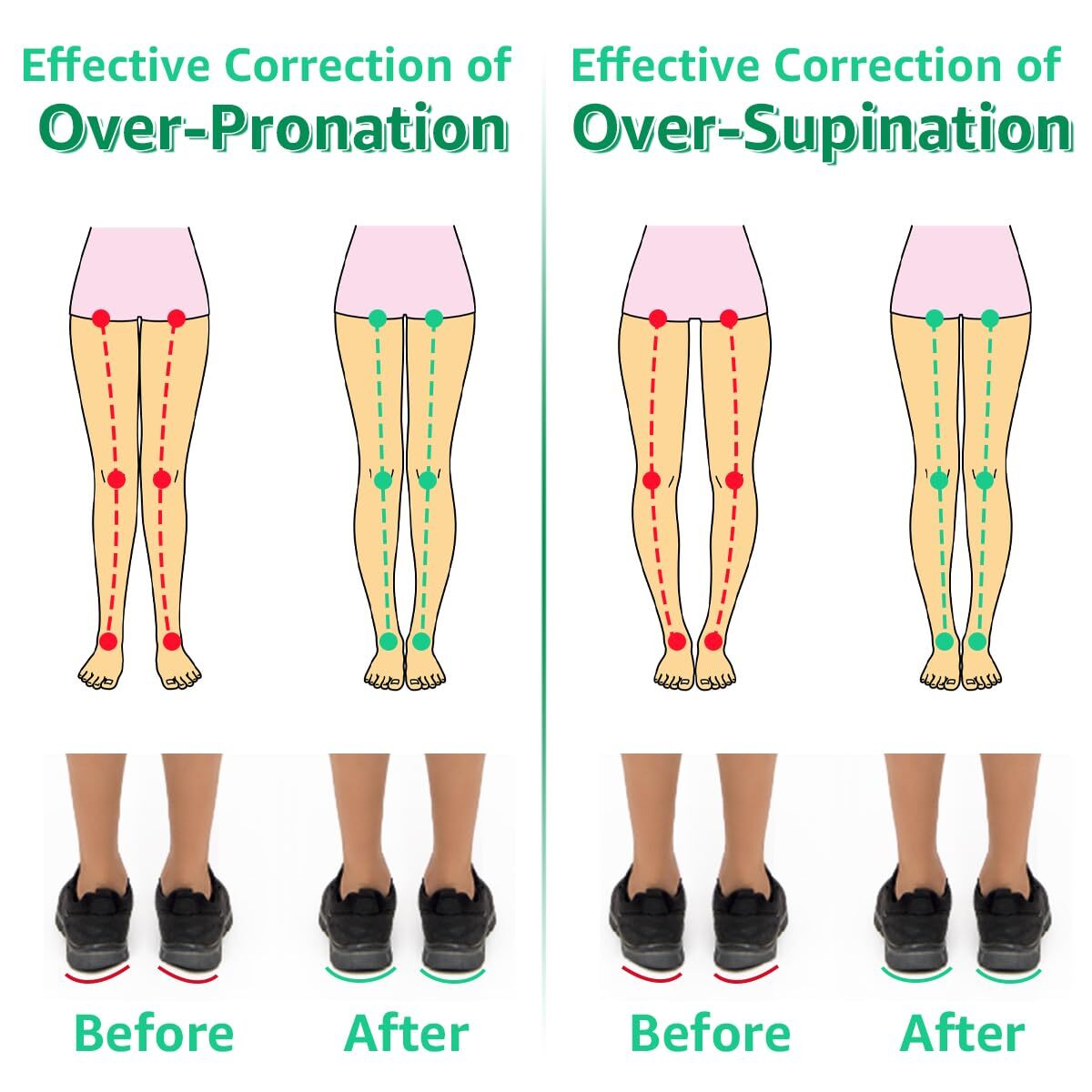 3 Layers Adjustable Heel Wedge Inserts for Supination & Pronation Correction,…