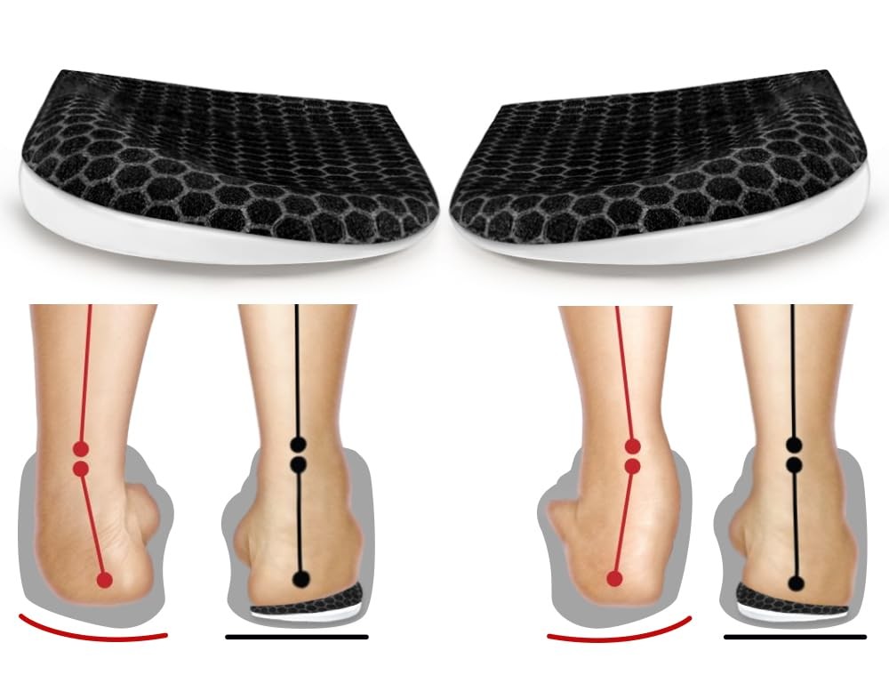 Corrective Insoles for Supination & Over-Pronation, Orthotics Medial & Latera…