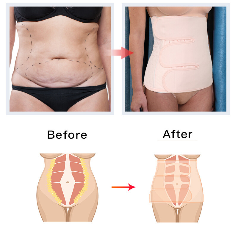 Faja Para Recuperacion De Cesarea Y Post Parto Moldeadora De Cintura Belt S M L