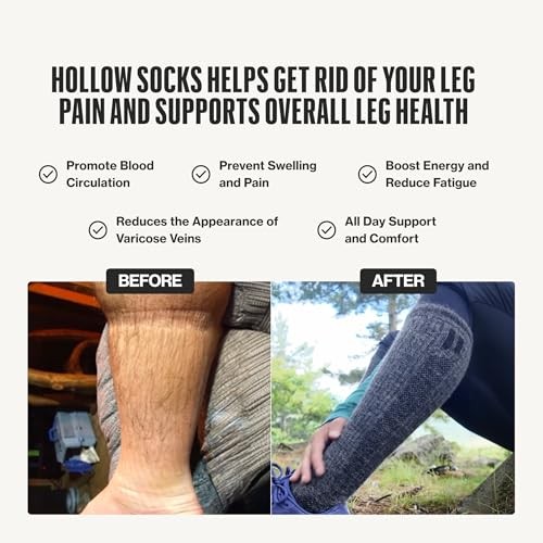 Alpaca Compression Socks for Men and Women, Moisture Wicking Alpaca Wool Sock…