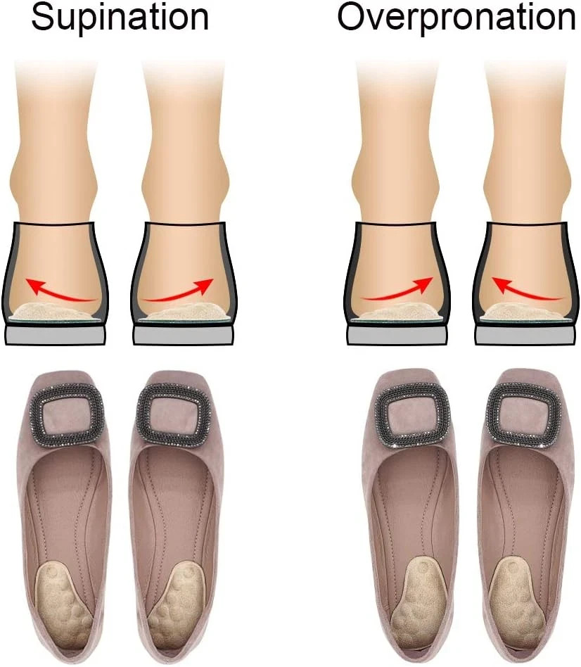 ‘S Supination & Over-Pronation Corrective Shoe Inserts, Medial & Lateral