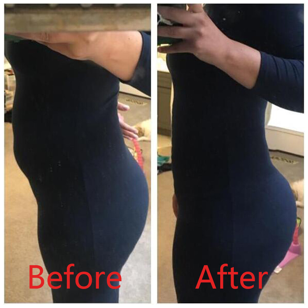 Full Body Shaper Women’s Compression Postpartum Shapewear Bodysuit Corset Girdle