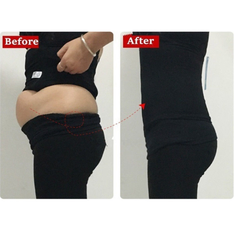 Postpartum Belly Recovery Band After Baby Tummy Tuck Belt Body Slimming Shaper