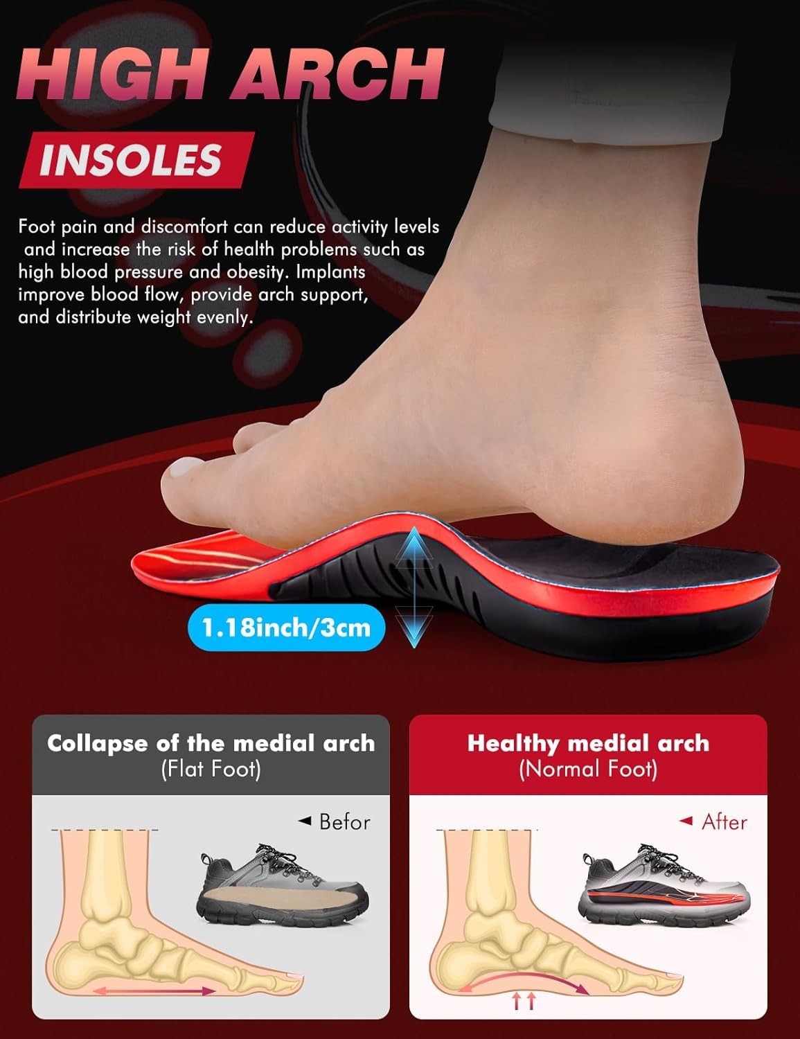 Plantar Fasciitis High Arch Support Insoles for Men Women, Arch Support Inserts.