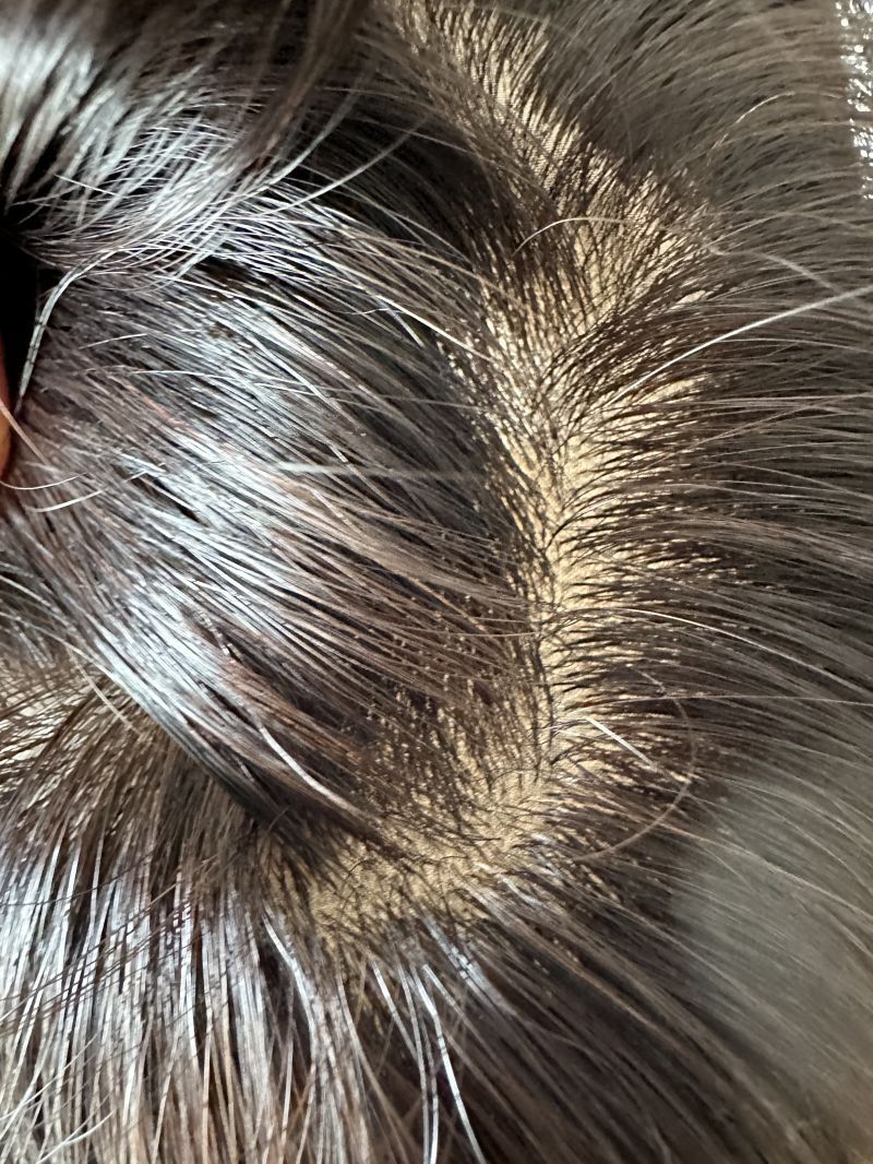 5.5″X6″ Silk Top High Density 100st Virgin Human Hair Topper for Women 8″~20″