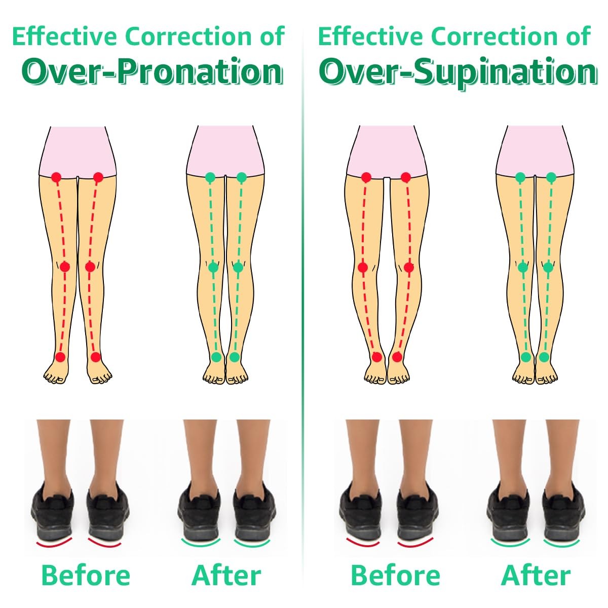 3 Layers Adjustable Heel Wedge Inserts for Supination & Pronation Correction,…